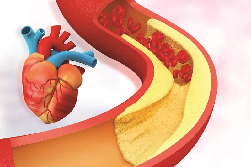 कोलेस्टेरॉलचे प्रकार व त्याचा हृदयावर परिणाम
