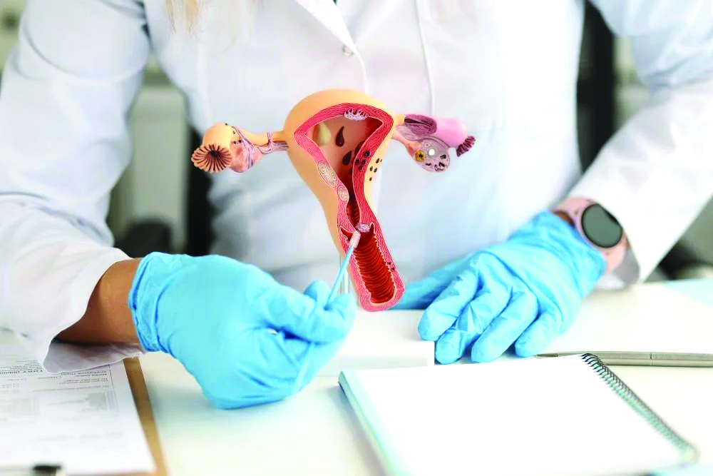 पेल्विक ऑर्गन प्रोलॅप्स