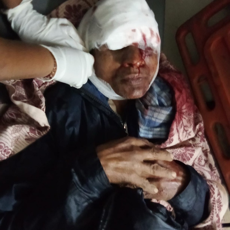 हुळंद-खानापूर येथे अस्वलाच्या हल्ल्यात गुराखी गंभीर जखमी