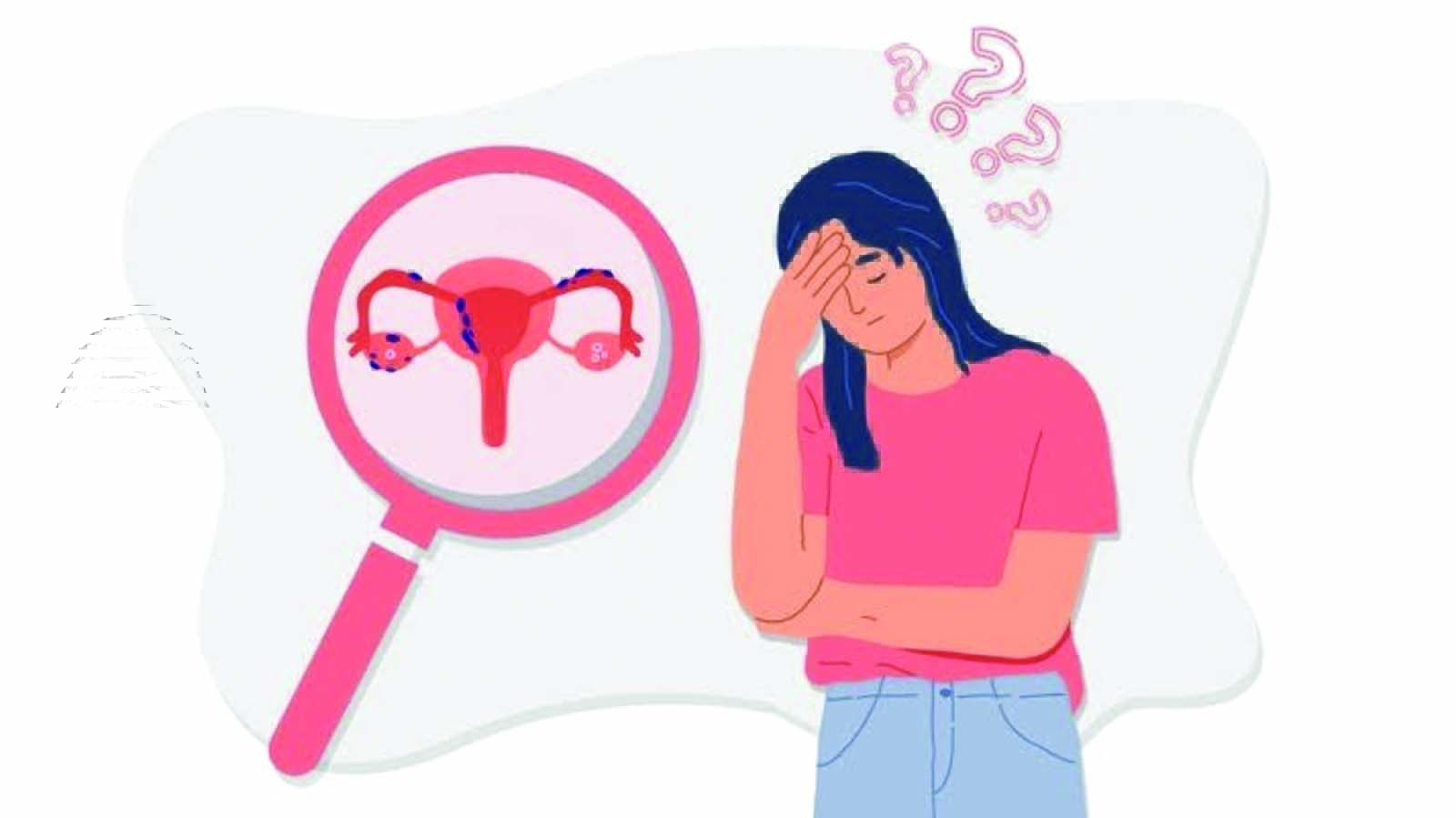 ४० वर्षांपूर्वी रजोनिवृत्ती: अकाली अंडाशय निकामी होणे (POI) - लक्षणे आणि उपचार