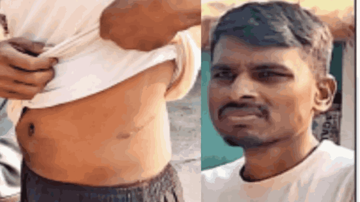 कर्ज फेडण्यासाठी शेतकरी सावकारी कर्जाच्या जाचात अडकला :कंबोडियात जाऊन विकले मूत्रपिंड