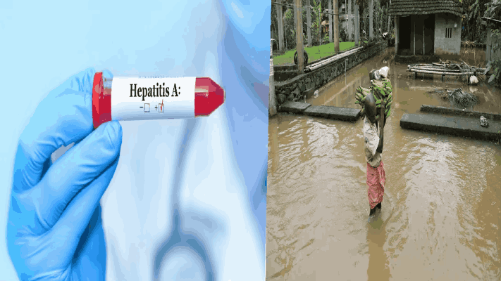 केरळमध्ये ‘हेपिटायटिस ए’चे रुग्ण वाढले : २०२५ च्या अखेरीस ३१ हजारांहून रुग्ण; ८२ जणांचा मृत्यू