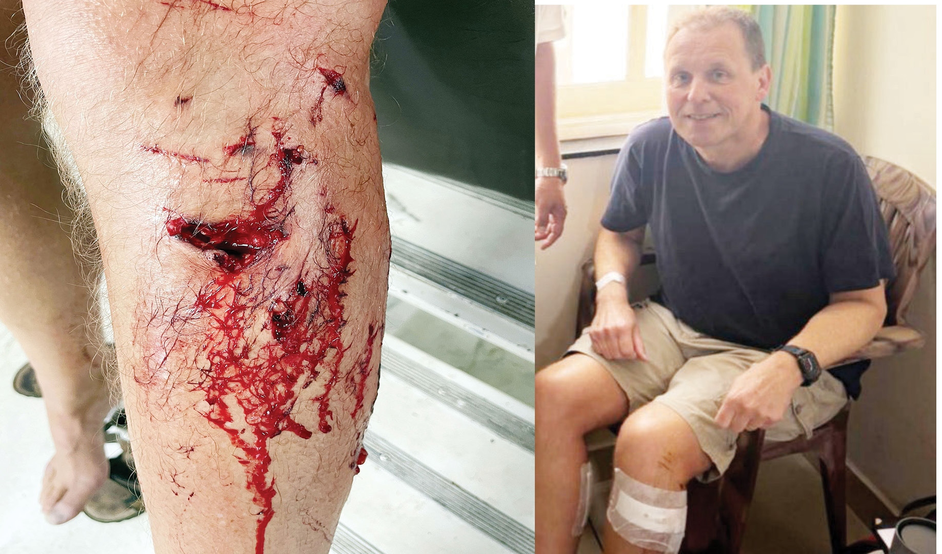 किनाऱ्यांवरील कुत्र्यांचा हैदोस पर्यटकांसाठी घातक